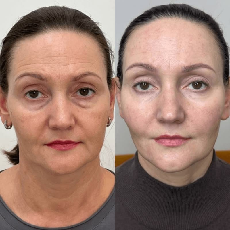 Customer photo review of True Skin Стягащ Крем с NAD+ и Пептиди