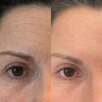 Customer photo review of True Skin Стягащ Крем с NAD+ и Пептиди