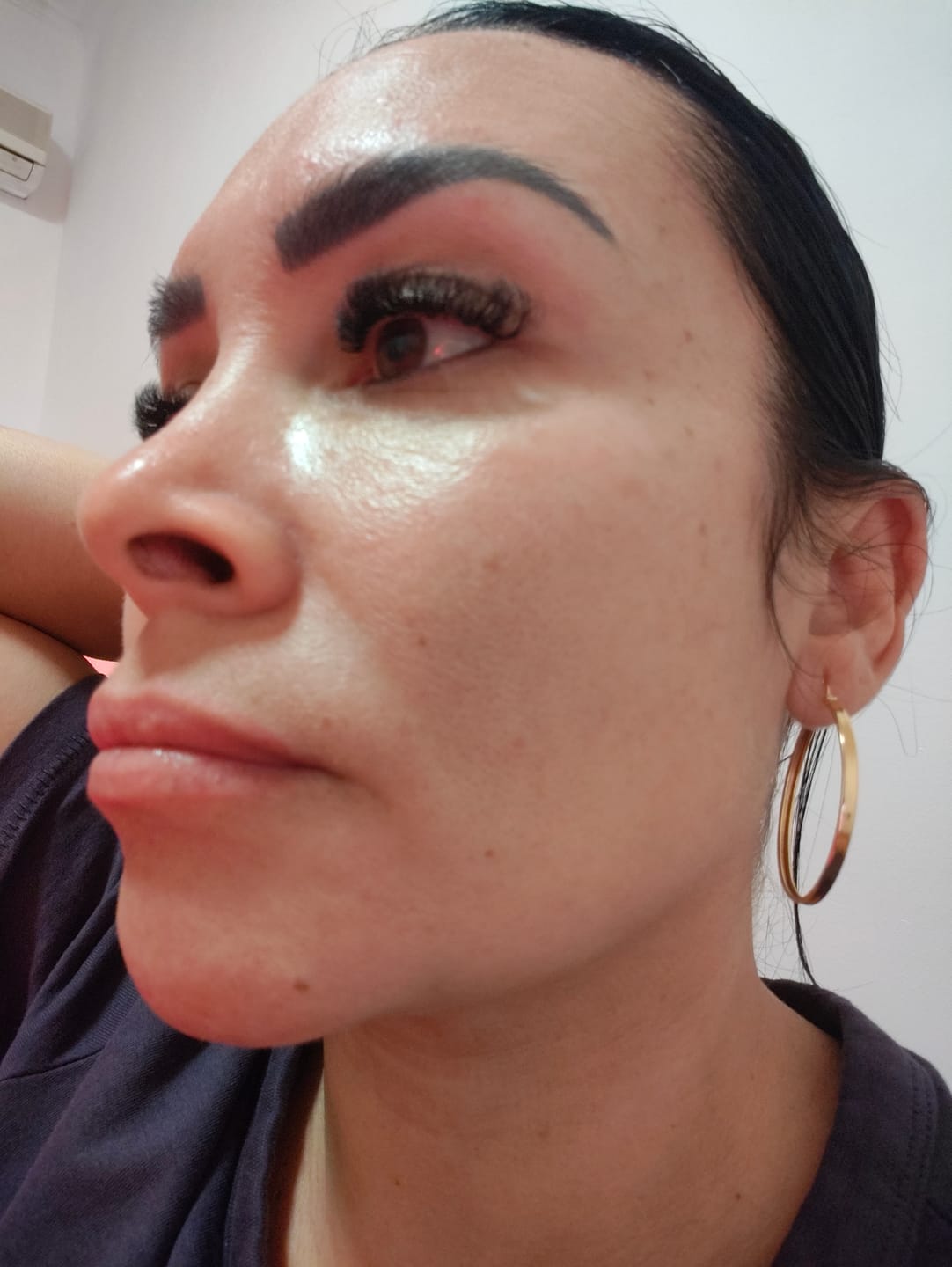 Customer photo review of A CONTROL - ACNÉ HORMONAL & RESISTENCIA A LA INSULINA
