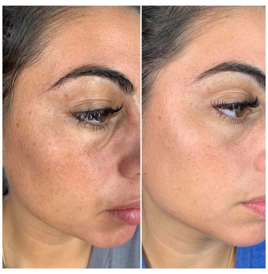 Customer photo review of True Skin Стягащ Крем с NAD+ и Пептиди