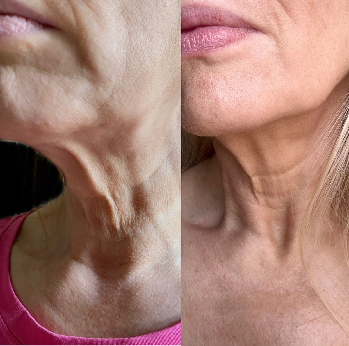Customer photo review of True Skin Стягащ Крем с NAD+ и Пептиди