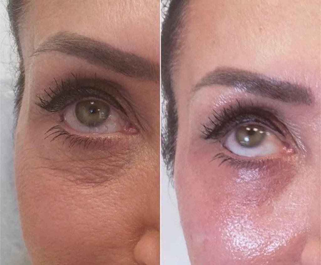 Customer photo review of True Skin Стягащ Крем с NAD+ и Пептиди