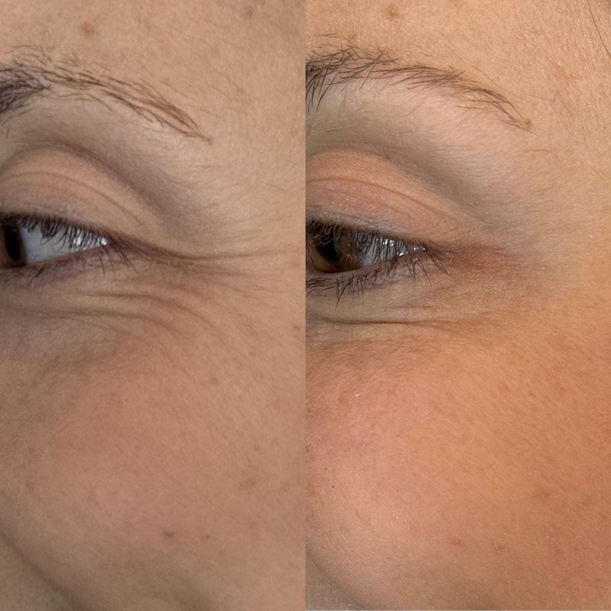 Customer photo review of True Skin Стягащ Крем с NAD+ и Пептиди