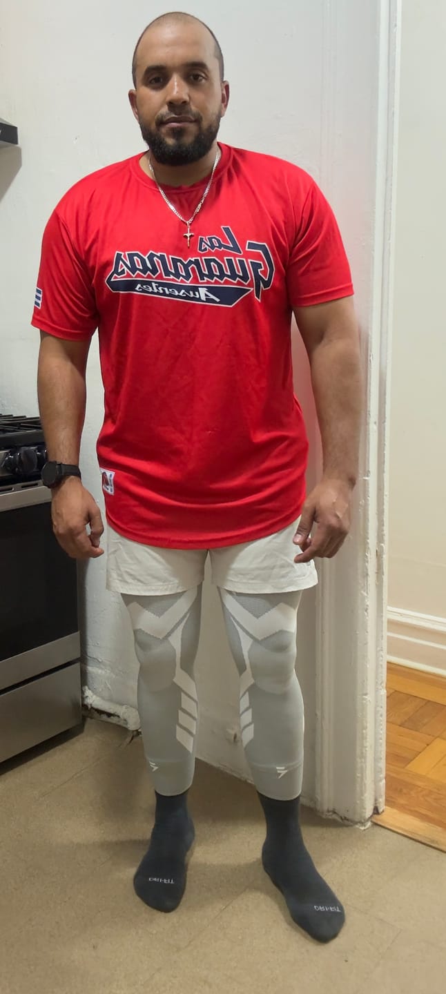 Customer photo review of Arm Compression Sleeves