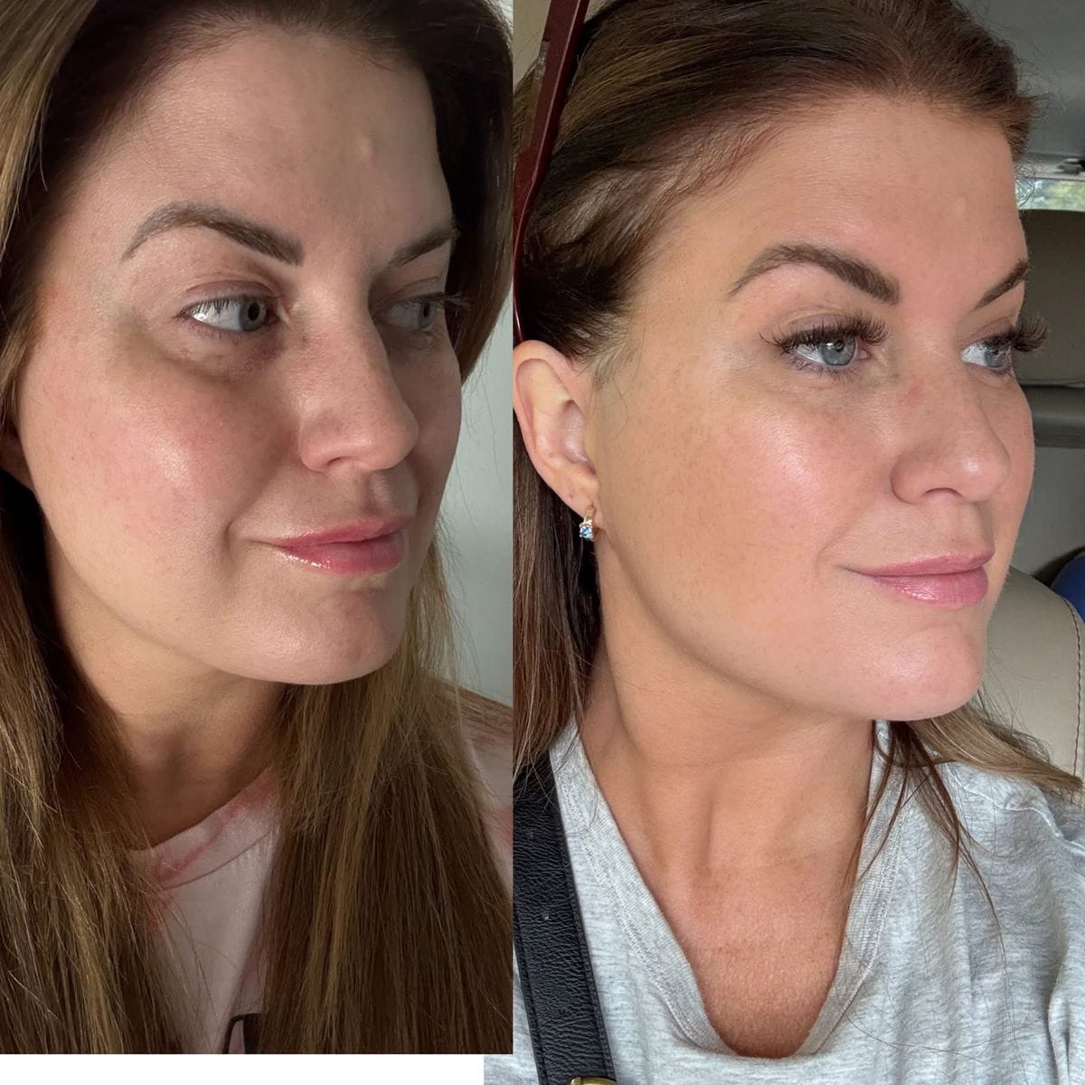 Customer photo review of True Skin Стягащ Крем с NAD+ и Пептиди
