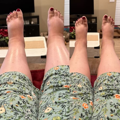 Customer photo review of Meias de bambu premium anti-fadiga