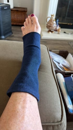 Customer photo review of Meias de bambu premium anti-fadiga