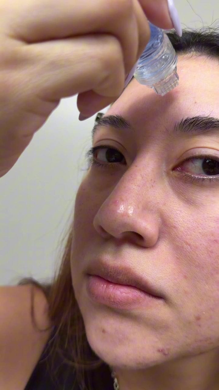 Customer photo review of GHK-Cu Micro-Infusion