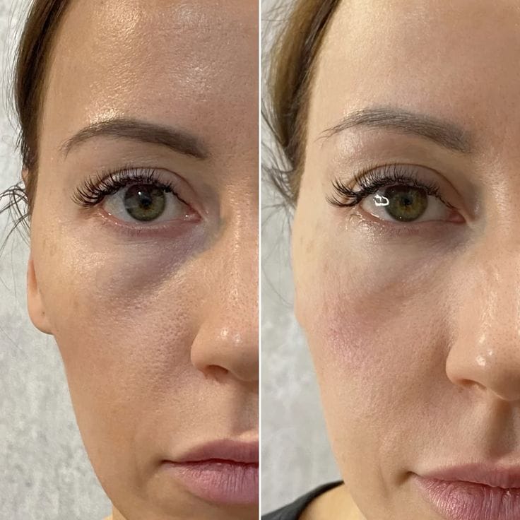 Customer photo review of True Skin Стягащ Крем с NAD+ и Пептиди