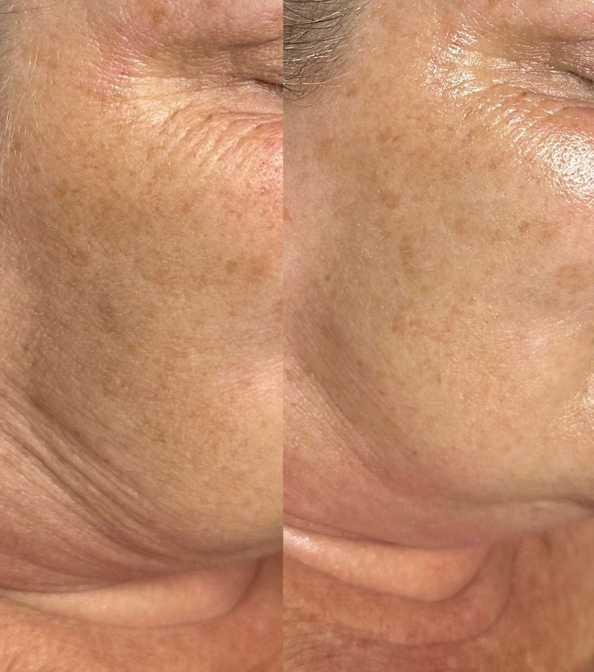 Customer photo review of True Skin Стягащ Крем с NAD+ и Пептиди