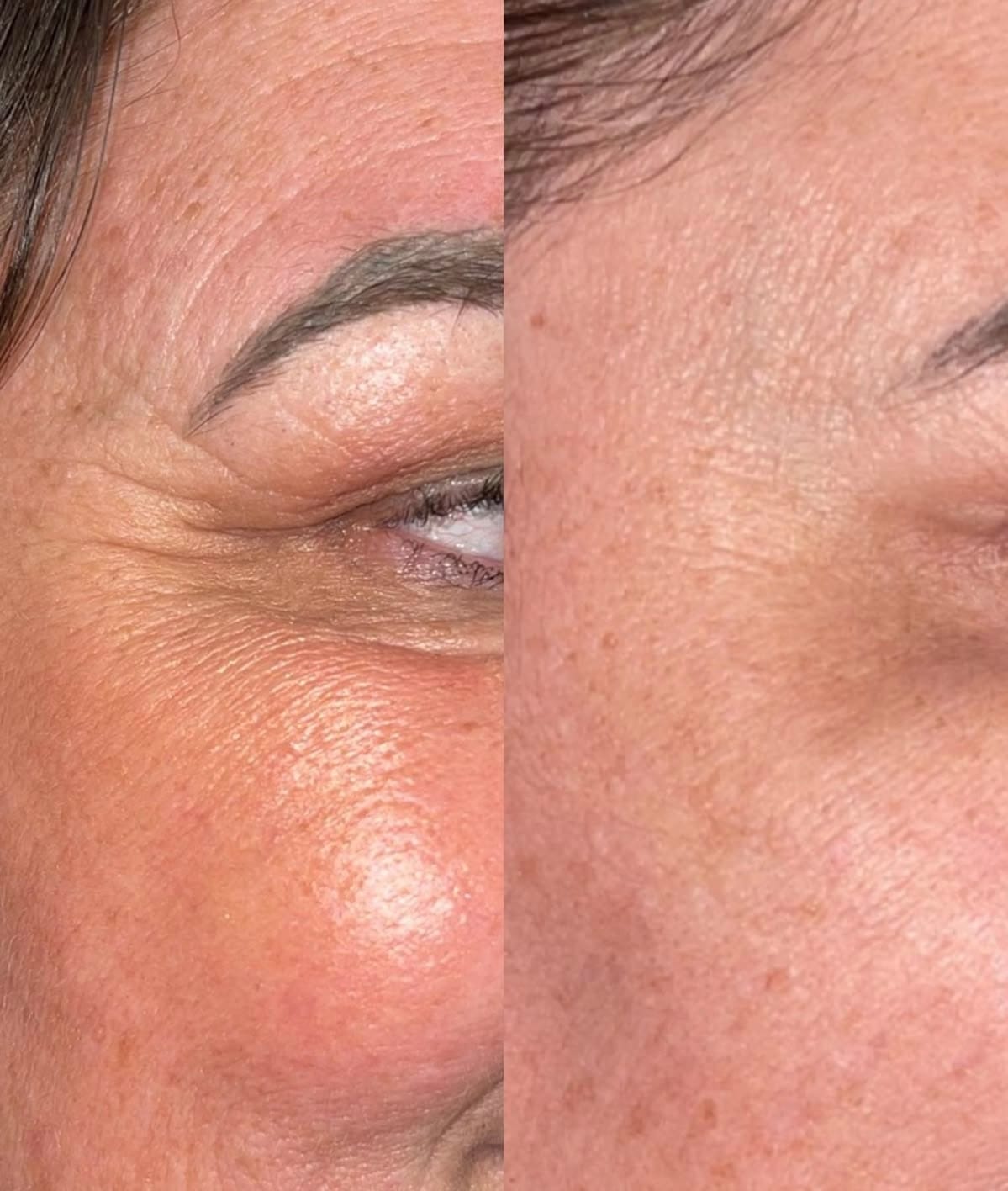 Customer photo review of True Skin Стягащ Крем с NAD+ и Пептиди