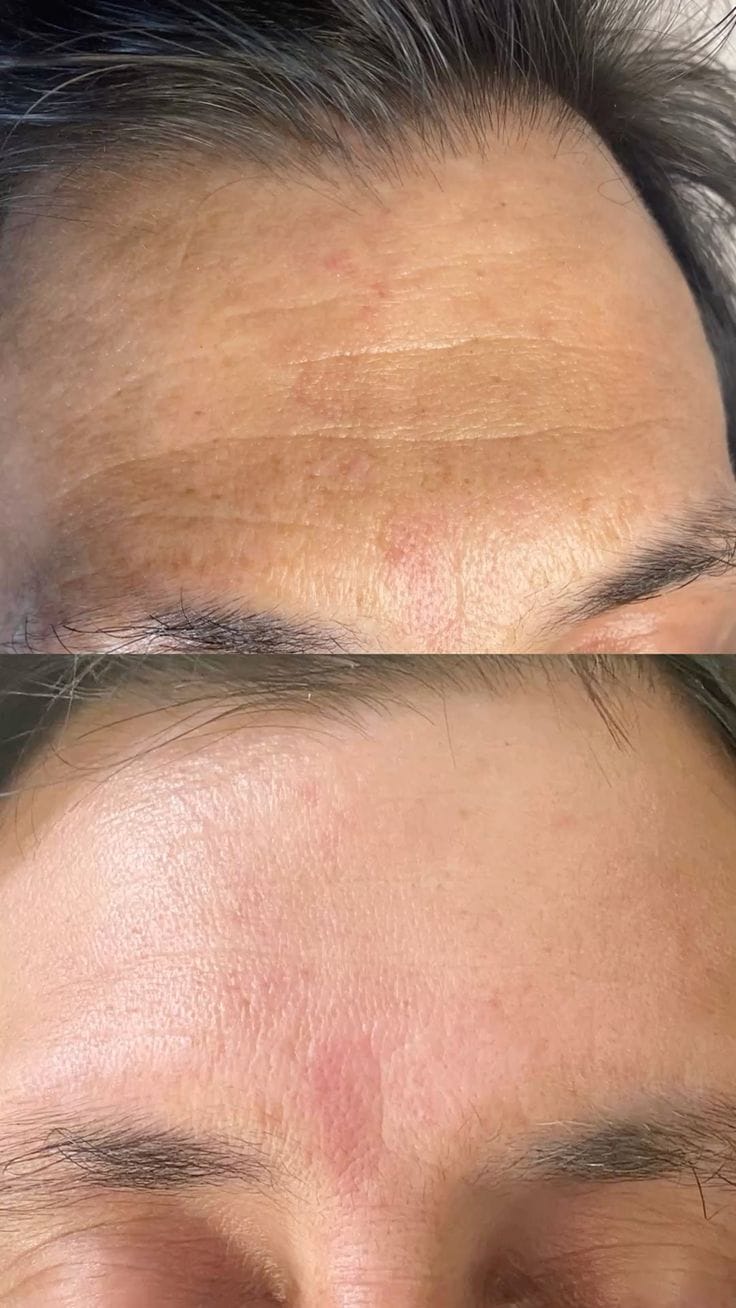 Customer photo review of True Skin Стягащ Крем с NAD+ и Пептиди