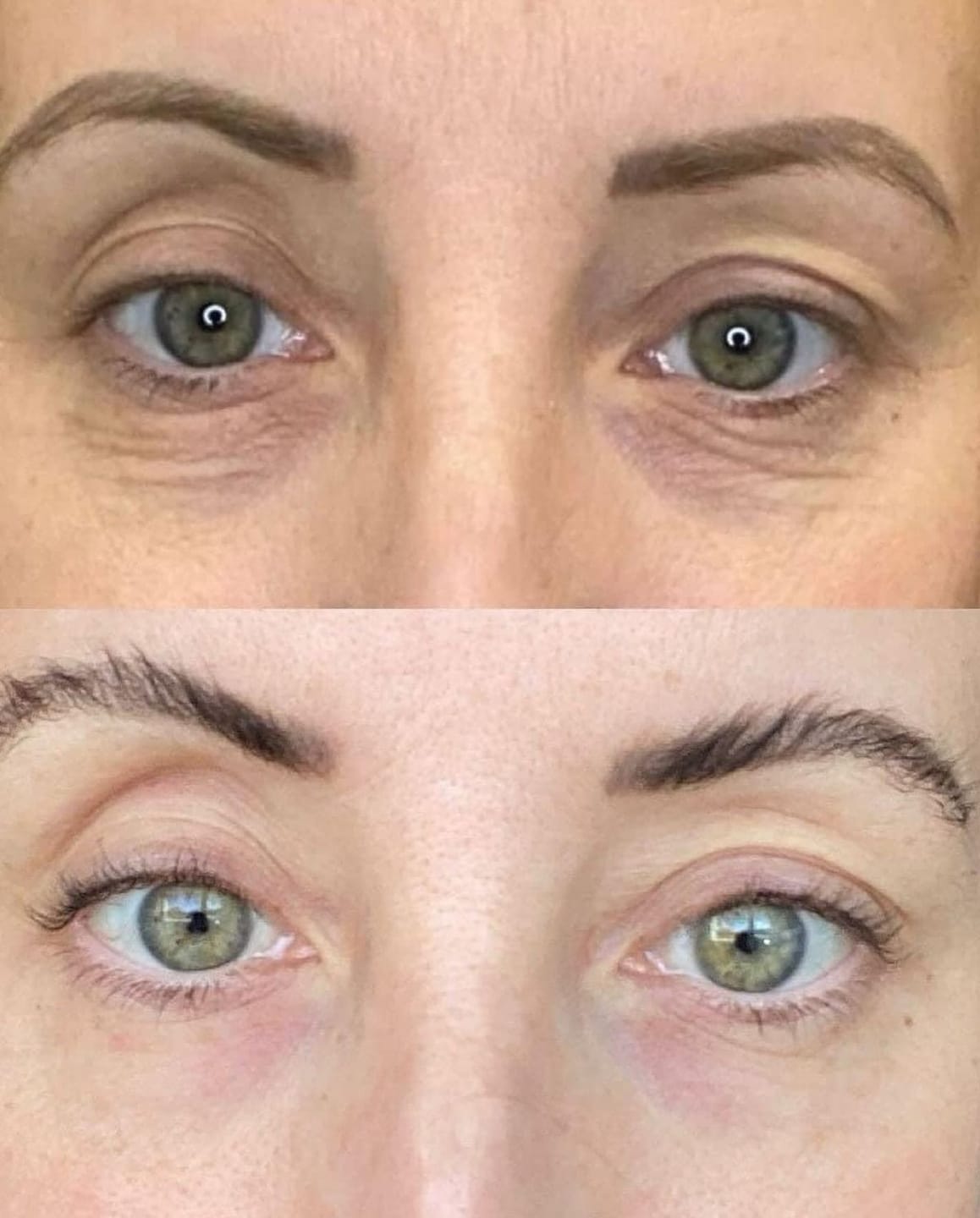 Customer photo review of True Skin Стягащ Крем с NAD+ и Пептиди