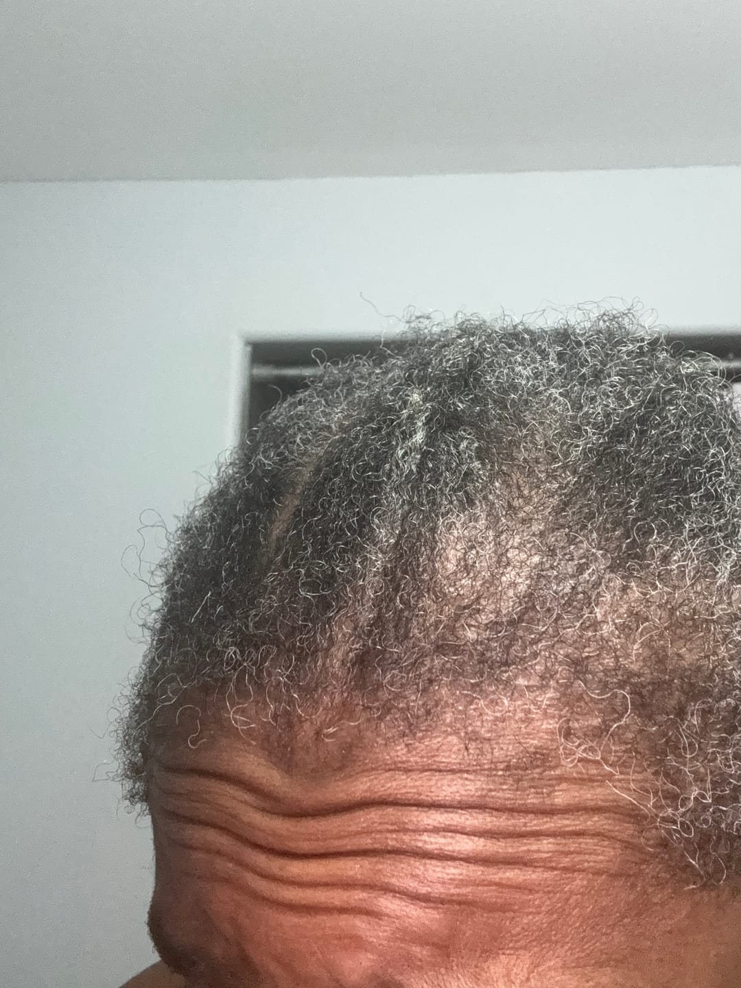 Customer photo review of BALM - Stimulating Scalp & Hair Balm