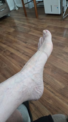 Customer photo review of Meias de bambu premium anti-fadiga