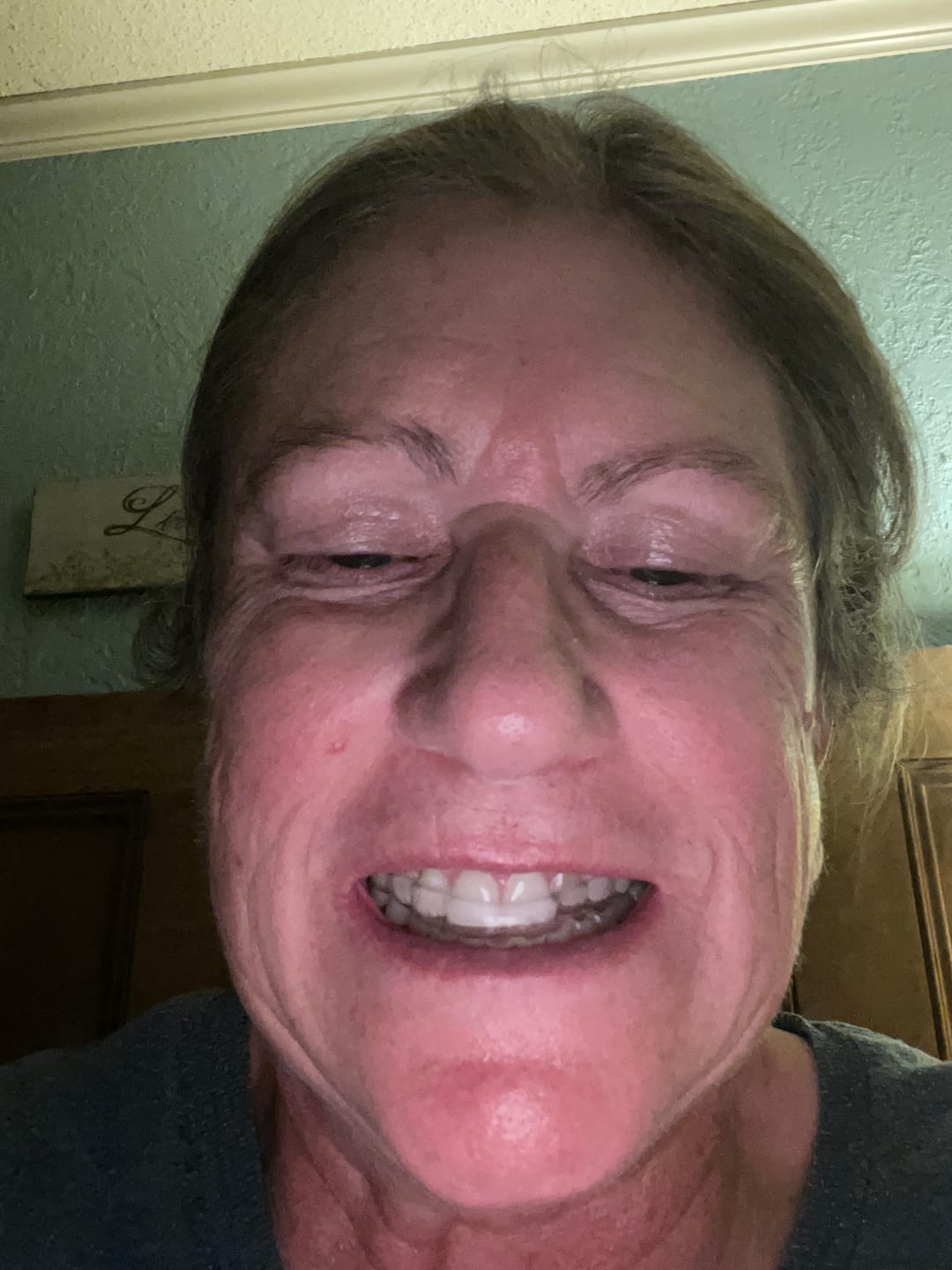 Customer photo review of Clear Custom Night Guard