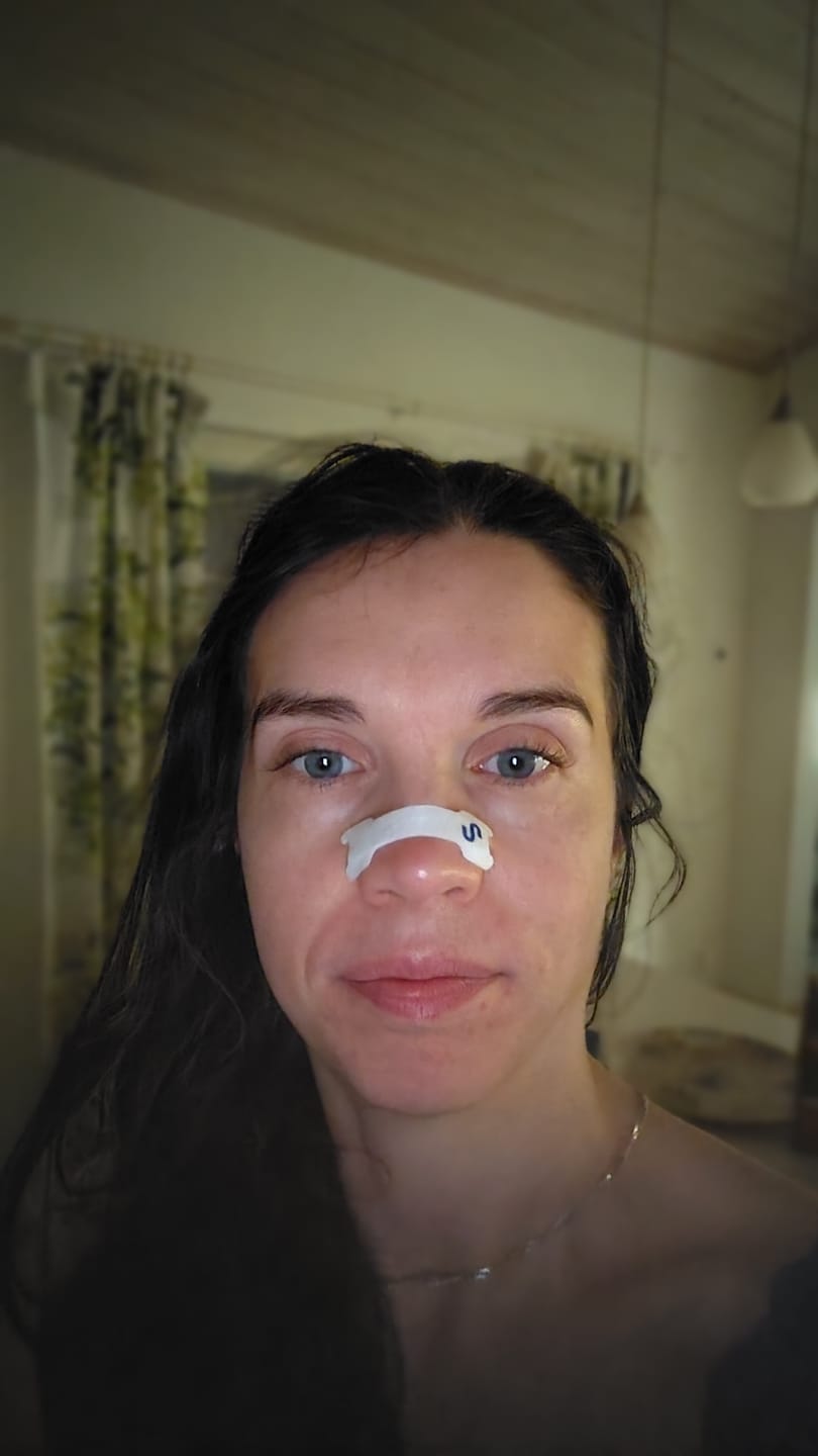Customer photo review of Nuku Sleep Nasal Strips