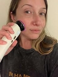 Customer photo review of ThermaLift™ Facial Massager