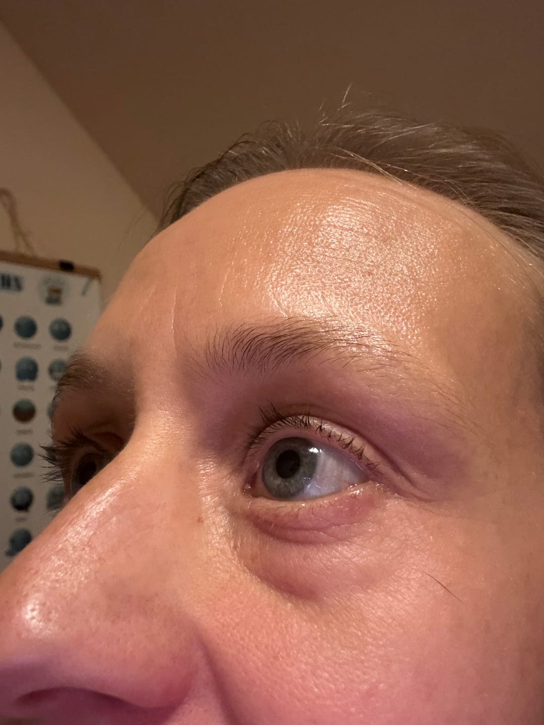 Customer photo review of Eye & Lip cream