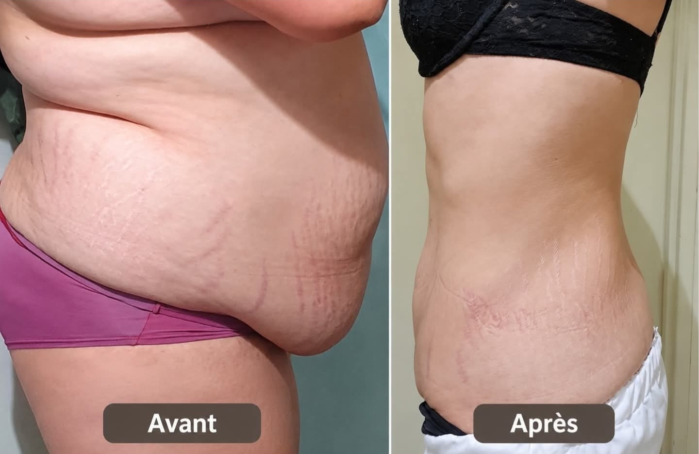 Customer photo review of Crème Raffermissante