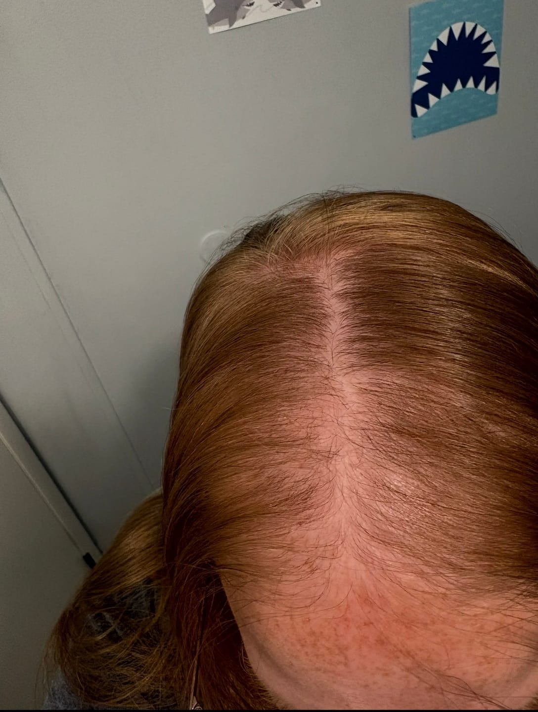 Customer photo review of Rosemary Biotin Conditioner Bar – Thinning Hair