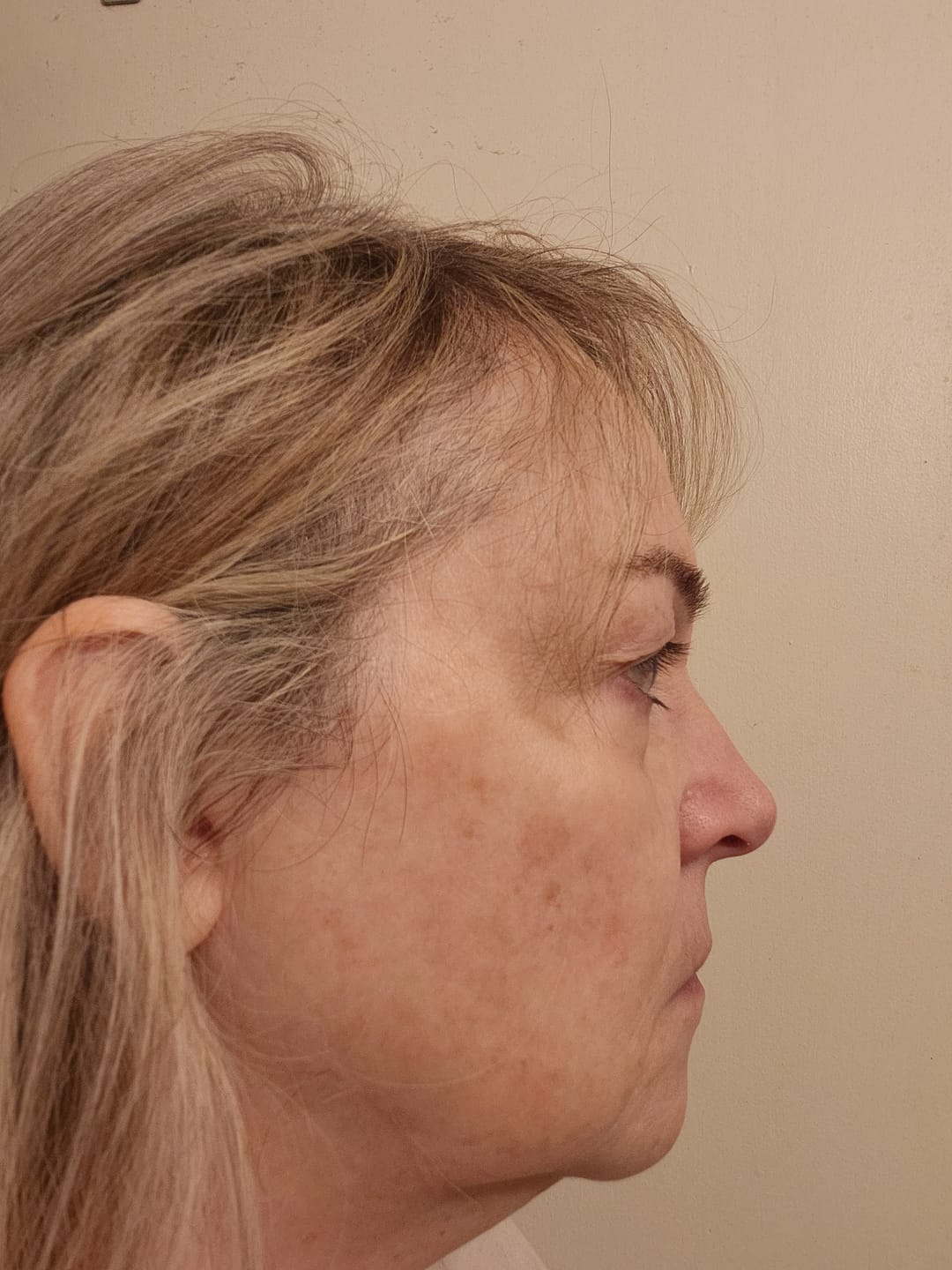 Customer photo review of ACTIVE PRO SERUM | ANTI-AGING