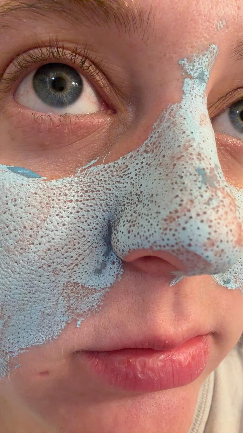 Customer photo review of BlackClear™ Clay Mask