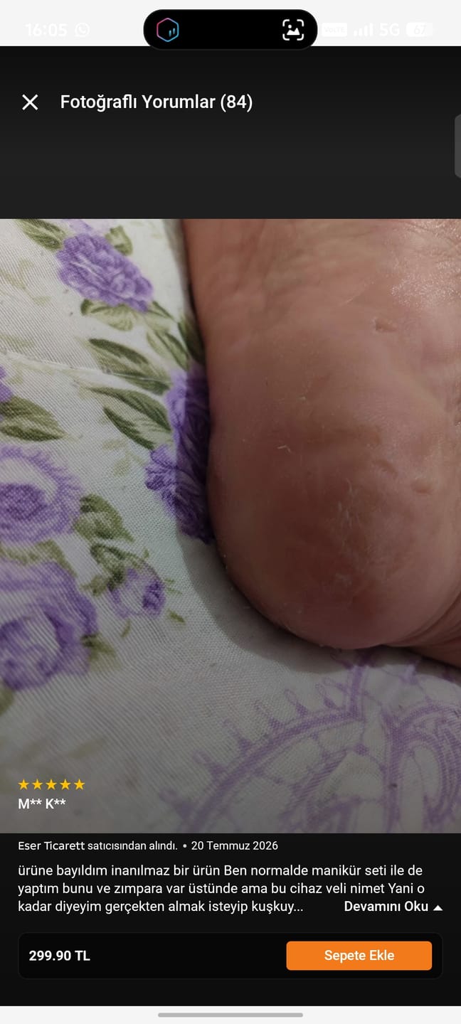 Customer photo review of Peluera™ Şarjı Nasır Ve Topuk Törpüsü