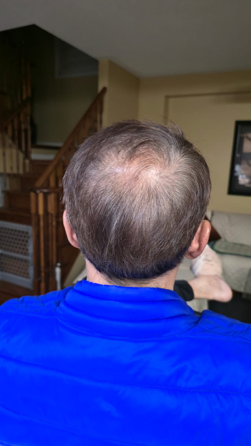 Customer photo review of SPARTAN™ - Instant Hair Dye Shampoo