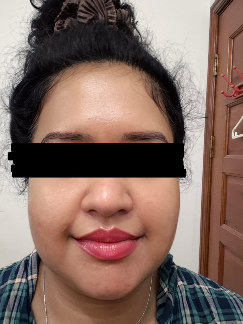 Customer photo review of Ventamin Clear It+: Doctor-Formulated Drink Mix for Acne & Breakout Control