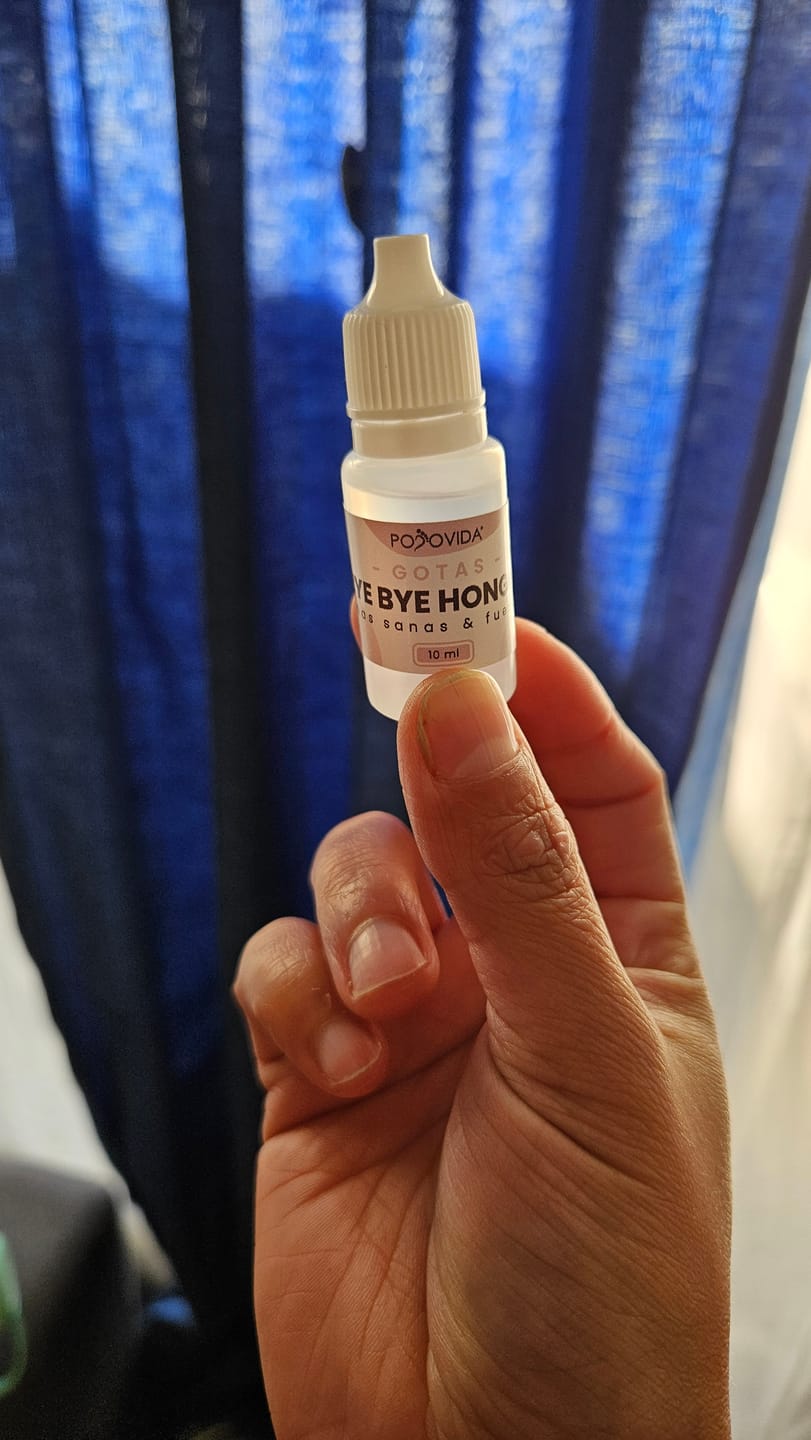 Customer photo review of Gotas ByeBye Hongos – Uñas Sanas & Fuertes