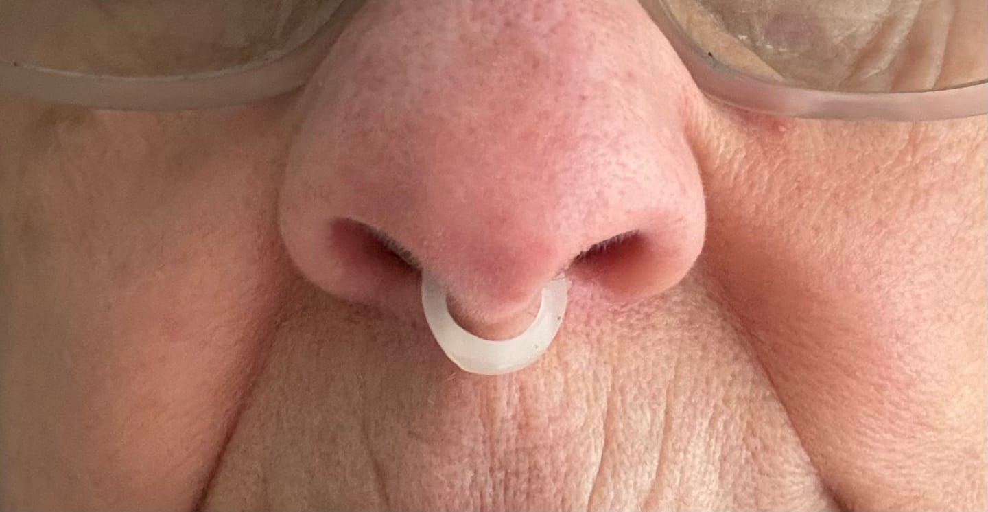 Customer photo review of Nasal Dilators BRISON
