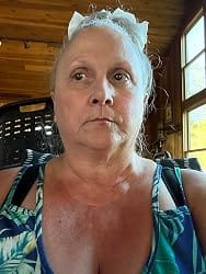 Customer photo review of ThermaLift™ Facial Massager