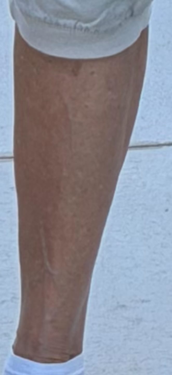 Customer photo review of Good Sun Auto-bronzant - 3 mois
