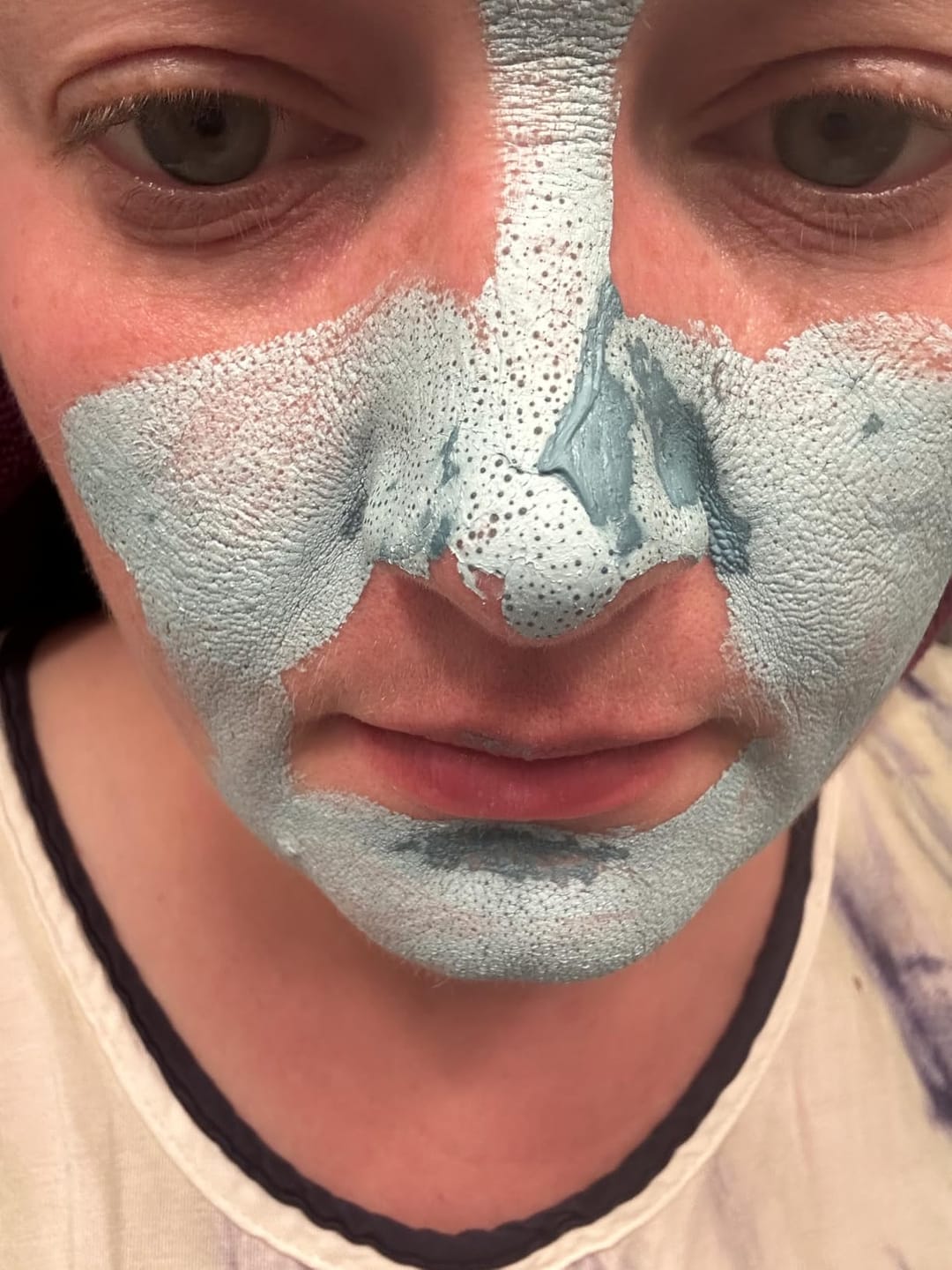Customer photo review of BlackClear™ Clay Mask