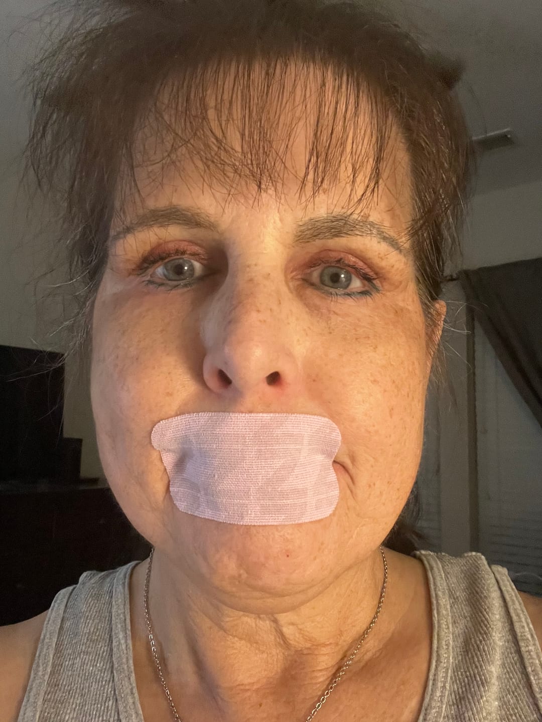 Customer photo review of ZzzTape - Mouth Tape