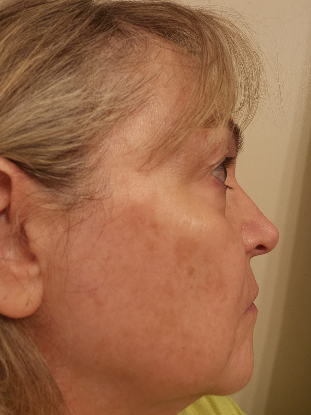 Customer photo review of CE SERUM | COMPLEXION BRIGHTENING