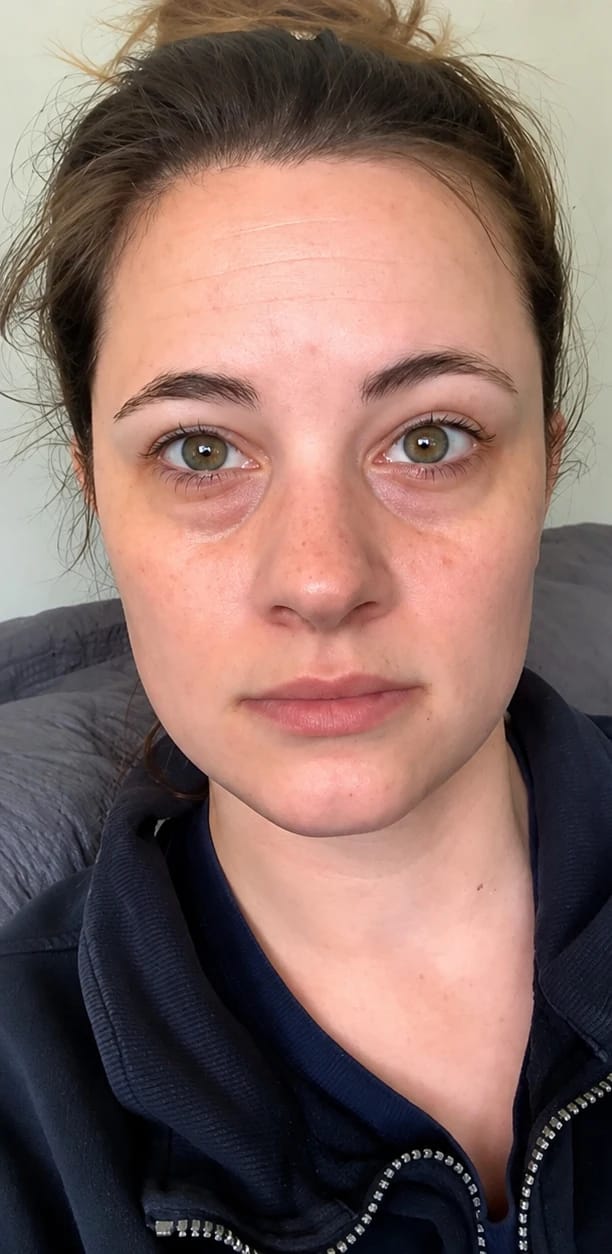 Customer photo review of Silicone LED Light Face Mask