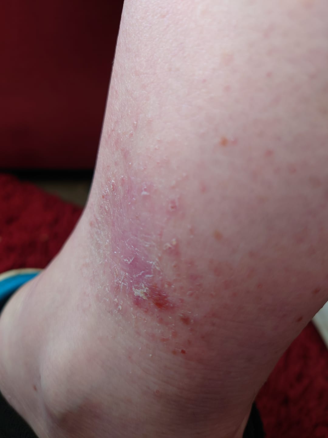 Customer photo review of Seb Natural Calming Serum