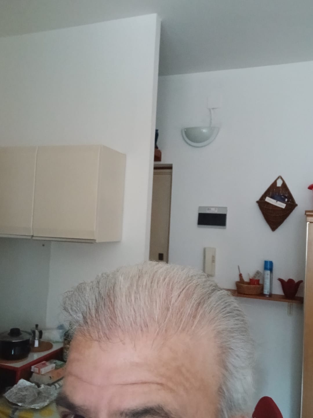 Customer photo review of HairFiberPlus – Fibre di Cotone per Capelli 27,5g | Grigio | Copri Diradamento (~60 giorni)