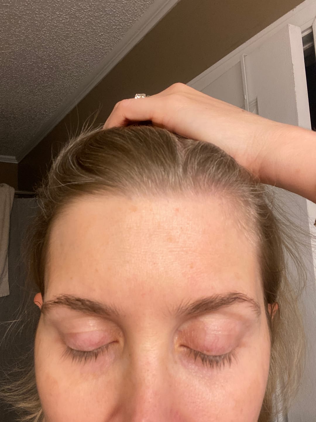 Customer photo review of Wrinkle Smoothing Night Balm