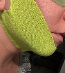 Customer photo review of CactiLift™ V-Face Mask