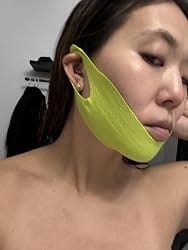 Customer photo review of CactiLift™ V-Face Mask