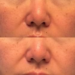 Customer photo review of GlutaLumi™ Brightening Serum