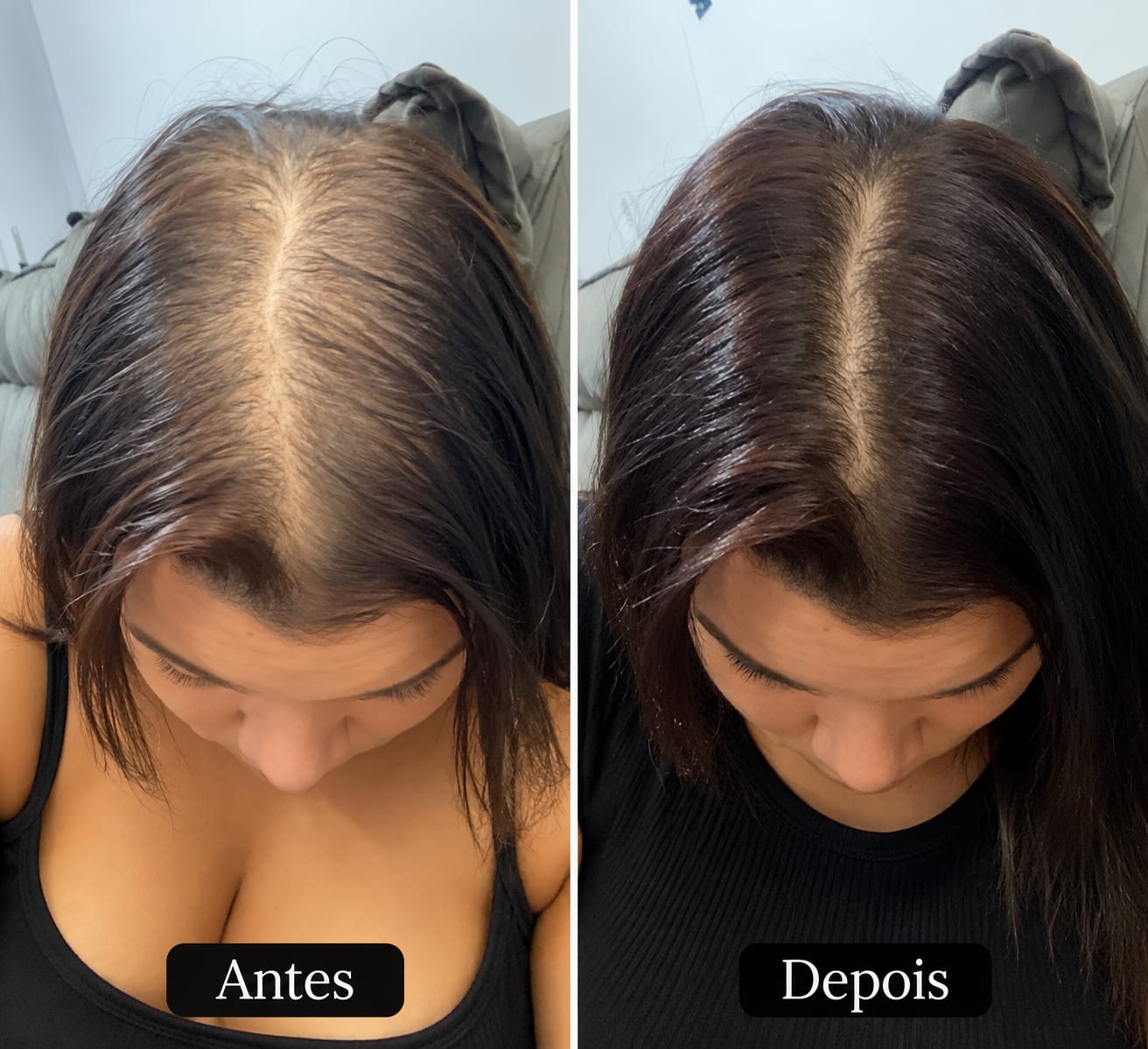 Customer photo review of Happy Hair 3 Potes Embaixadores