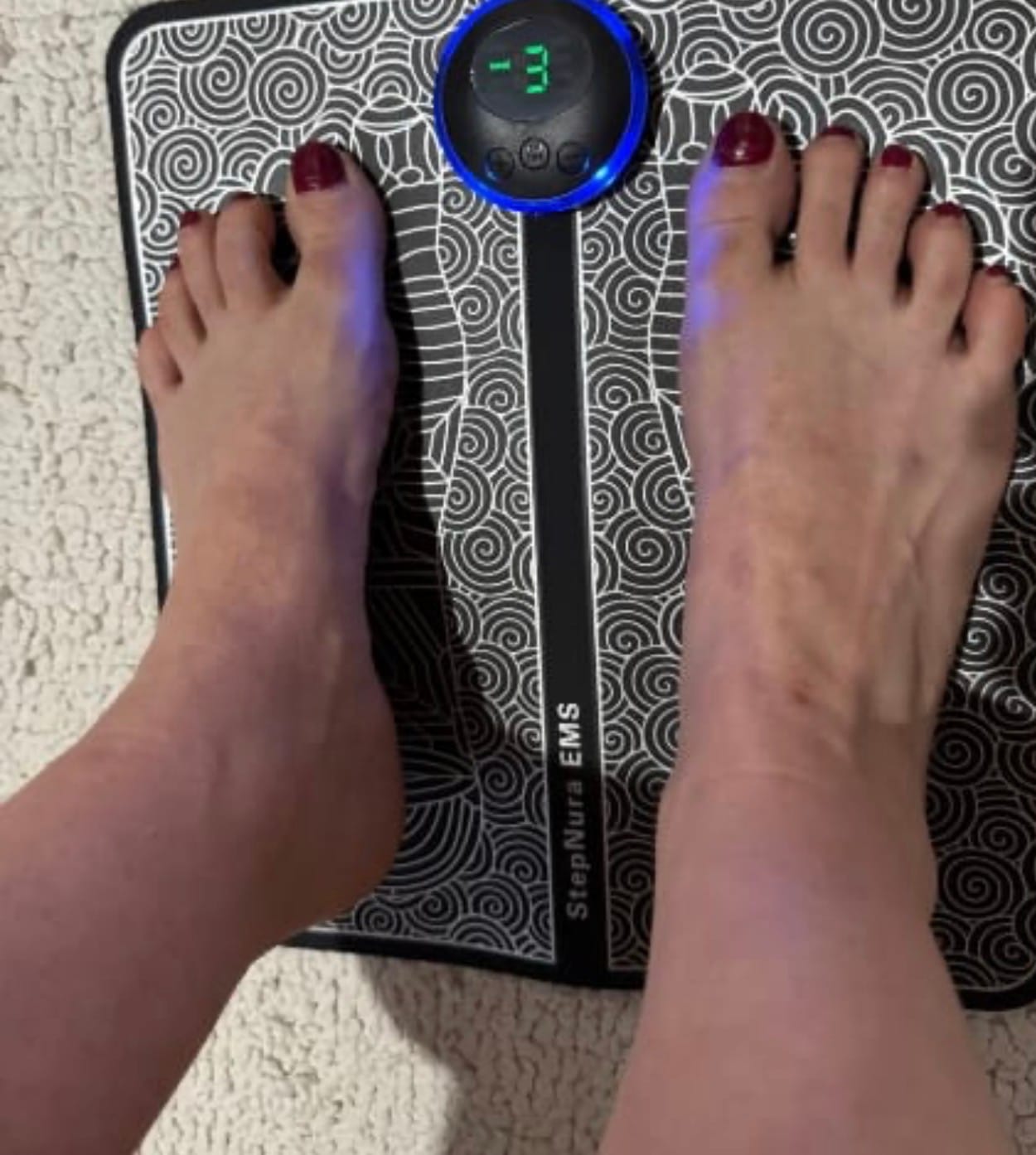 Customer photo review of Estimulador EMS para Piernas Hinchadas