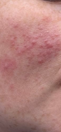 Customer photo review of Rosalique Ultimate Cream Duo