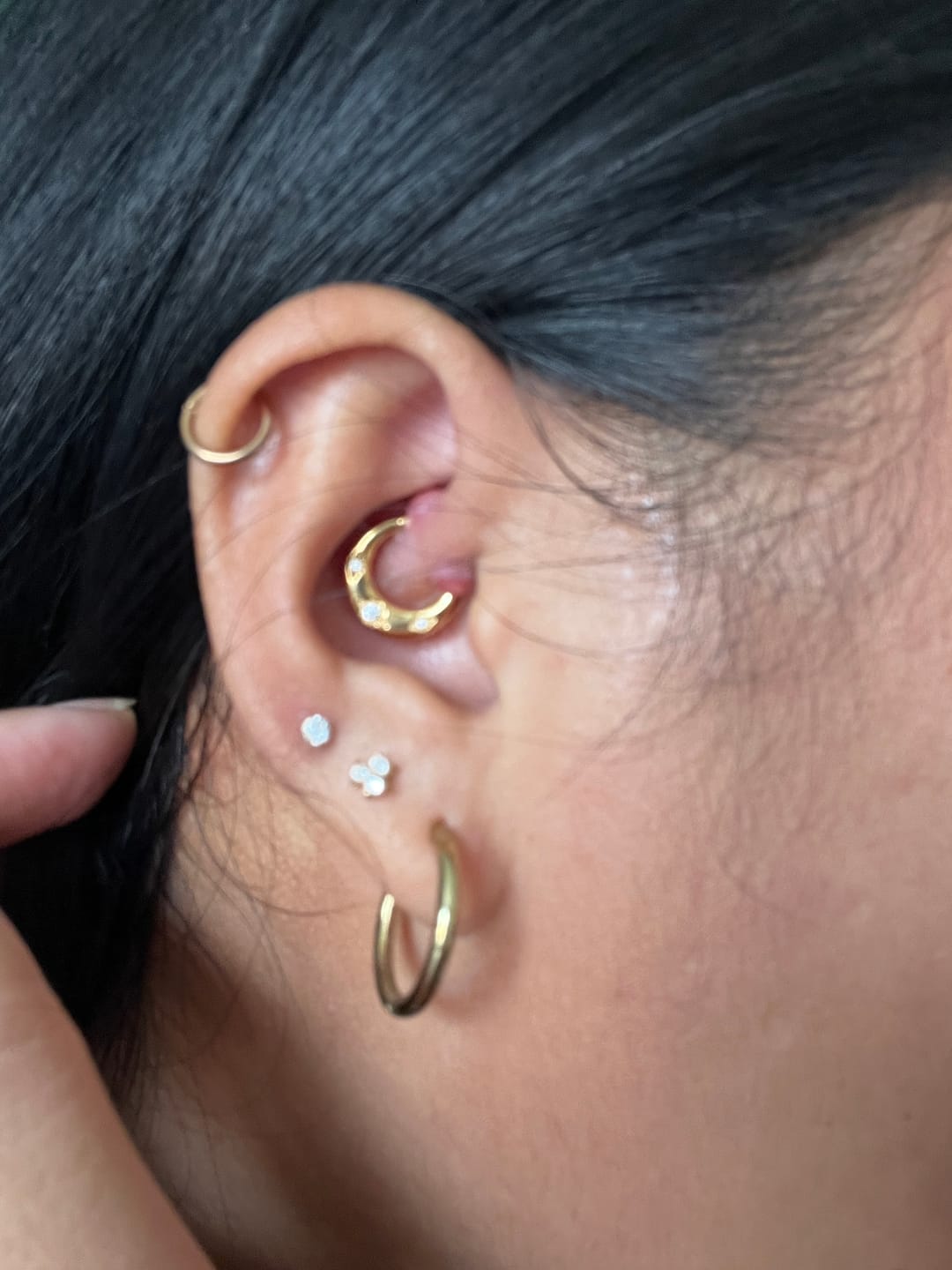 Customer photo review of Piercing Bump Emergency Trio