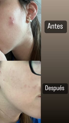 Customer photo review of Defense Barrera Protectora — 125 ml, rinde 2.5 frascos