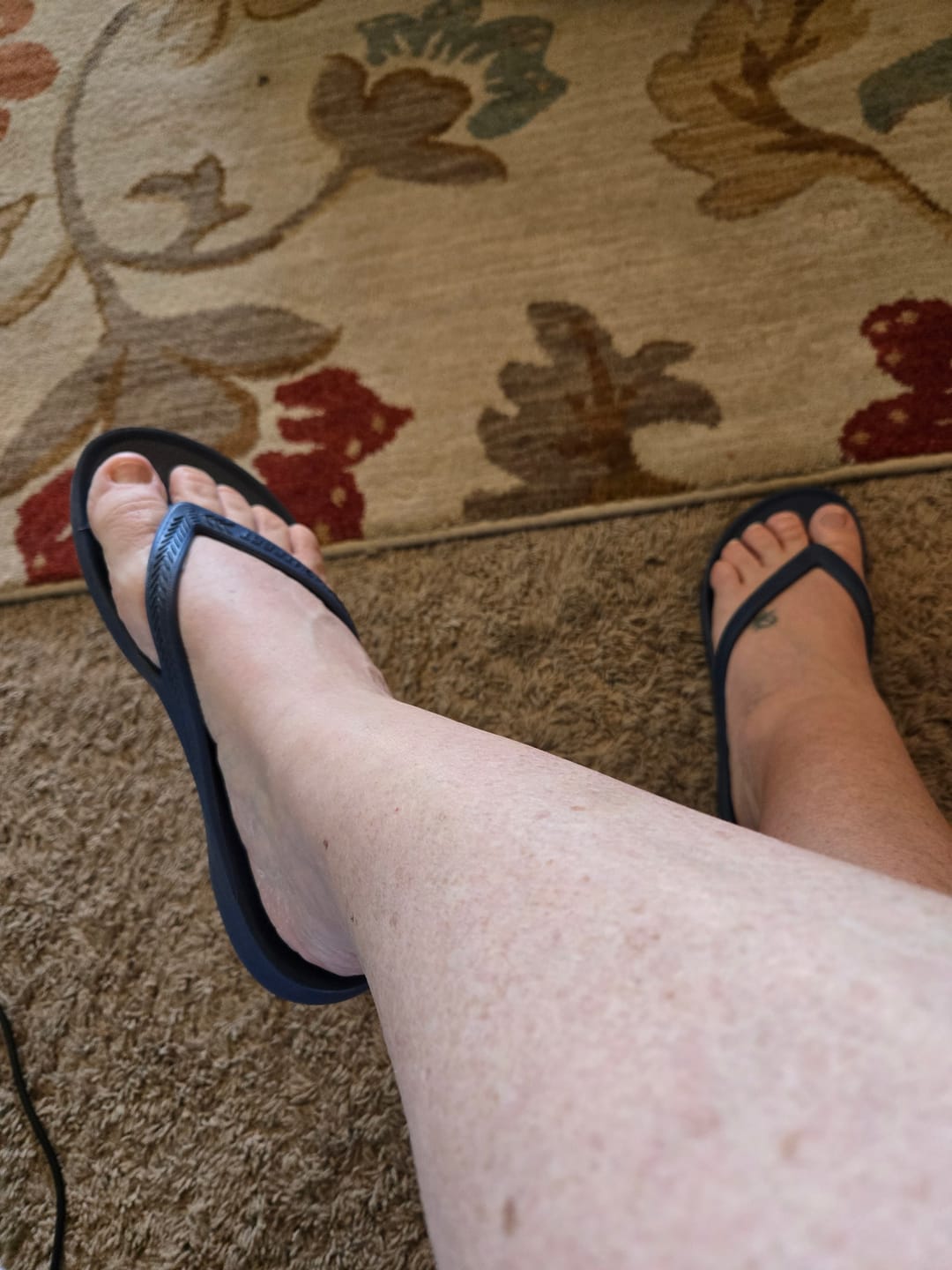Customer photo review of Navy - Lightfeet Arch Support Flip Flops